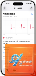 cách chia sẻ kết quả ecg iphone