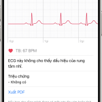 Cách chia sẻ kết quả ECG iPhone chi tiết và nhanh chóng cho bác sĩ cách chia sẻ kết quả ecg iphone