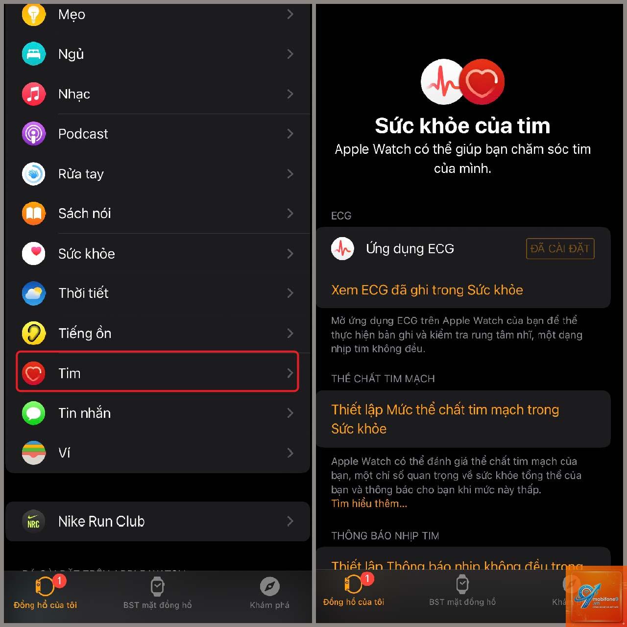 cách quản lý dữ liệu ecg iphone - Hình 3