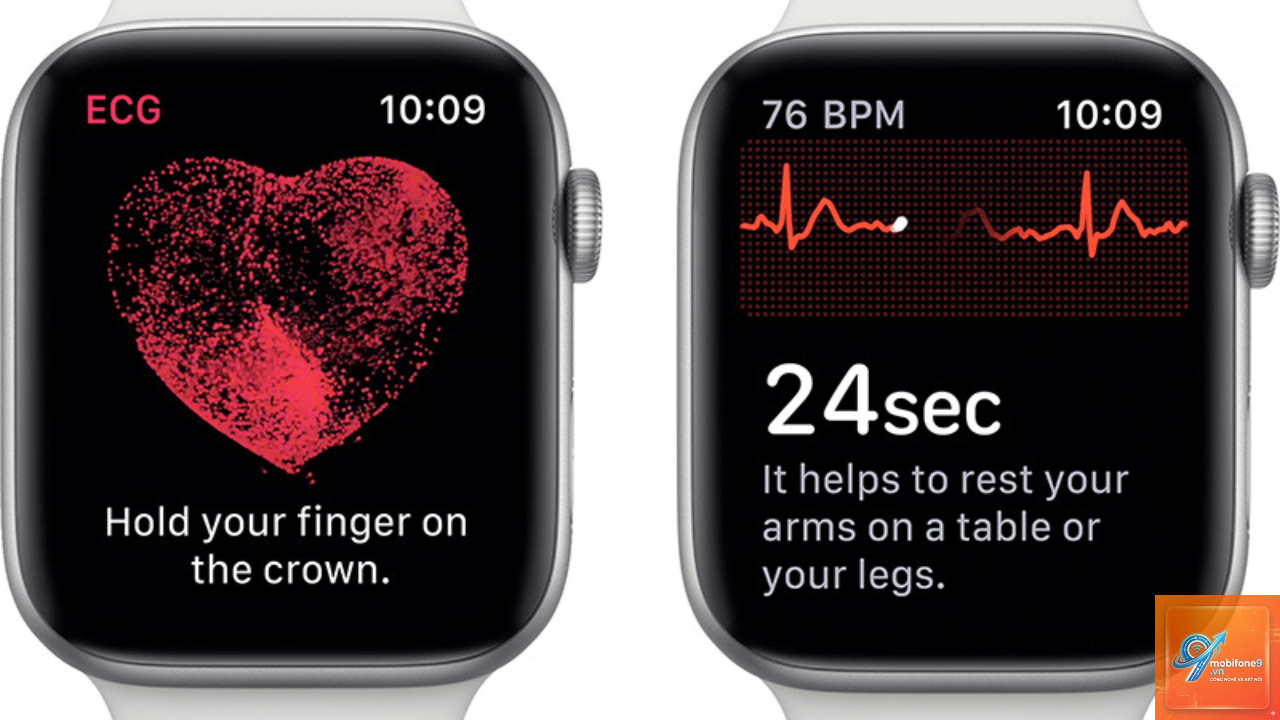 cách quản lý dữ liệu ecg iphone - Hình 4