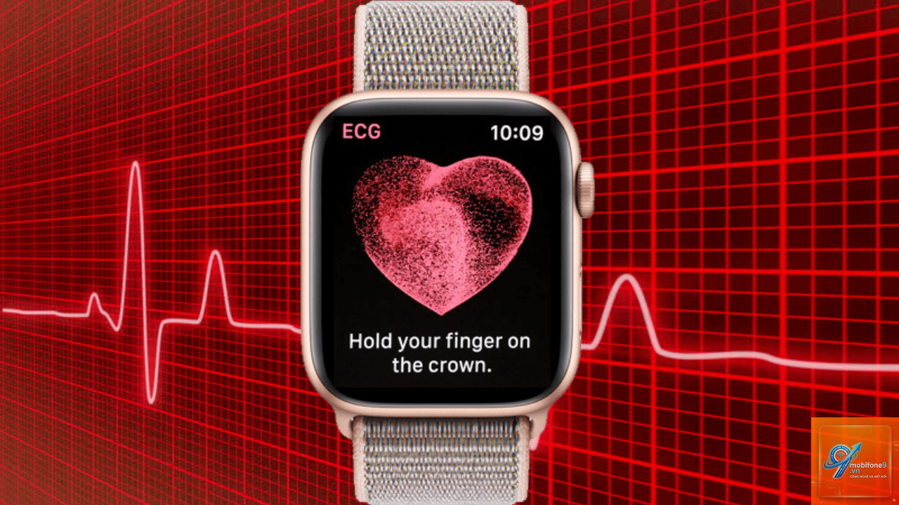 cách quản lý dữ liệu ecg iphone - Hình 5