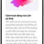 Cách theo dõi rung nhĩ iPhone: Hướng dẫn chi tiết từ A đến Z cho người mới bắt đầu cách theo dõi rung nhĩ iphone