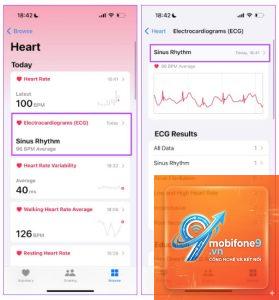 cách xuất kết quả ecg iphone