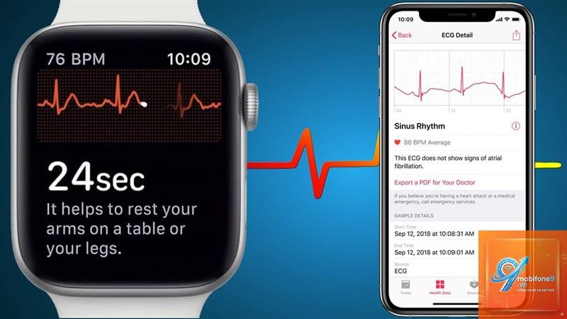 ecg bị lỗi cảm biến - Hình 4