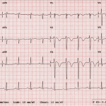 ECG Bị Lỗi Sau Cập Nhật: Nguyên Nhân, Cách Khắc Phục Và Những Điều Cần Biết ECG Bị Lỗi Sau Cập Nhật: Nguyên Nhân, Cách Khắc Phục Và Những Điều Cần Biết