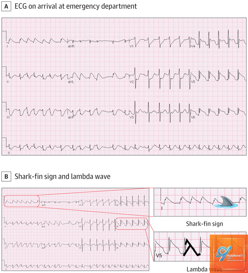 ecg không chia sẻ được - Hình 3