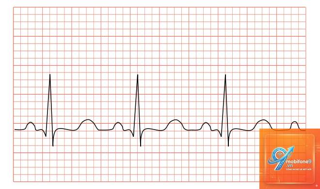 ecg không chia sẻ được - Hình 4