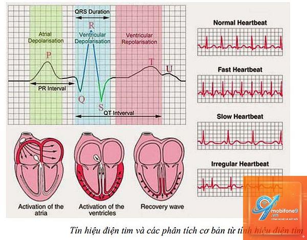 ecg không chia sẻ được - Hình 1