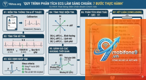 ecg không đồng bộ dữ liệu