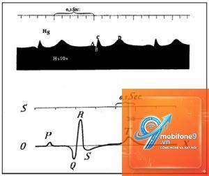 ecg không hiển thị lịch sử