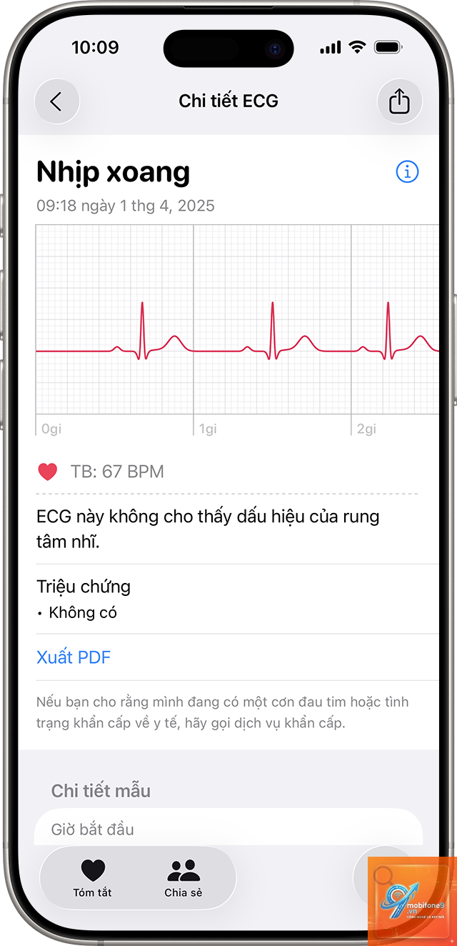 ecg không hoạt động trên iphone - Hình 2