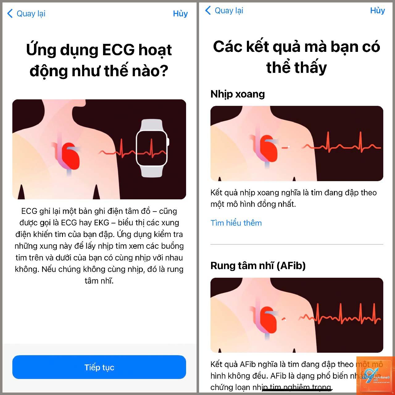 ecg không hoạt động trên iphone - Hình 3
