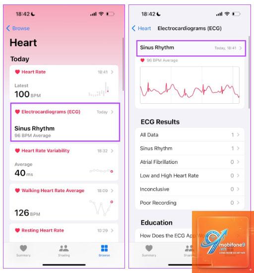 ecg không hoạt động trên iphone - Hình 5