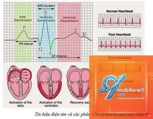 ecg không lưu kết quả