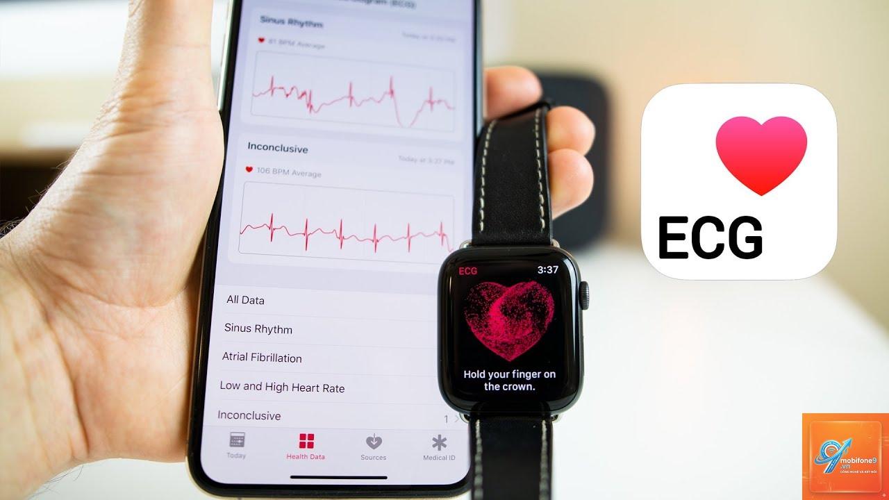 ecg không nhận dữ liệu apple watch - Hình 5