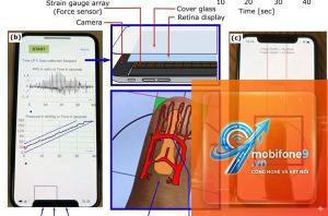 máy đo huyết áp cho iPhone